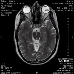 Brain Scan Eye Redacted