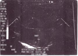 Davyd's Ultrasound 09-21-1994